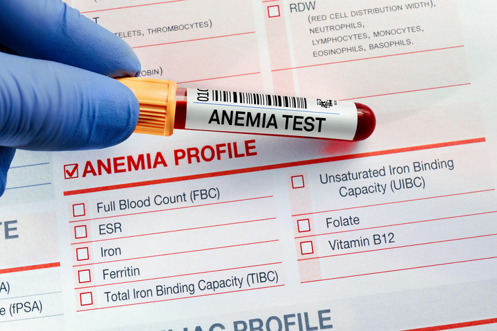 Síntomas de la anemia