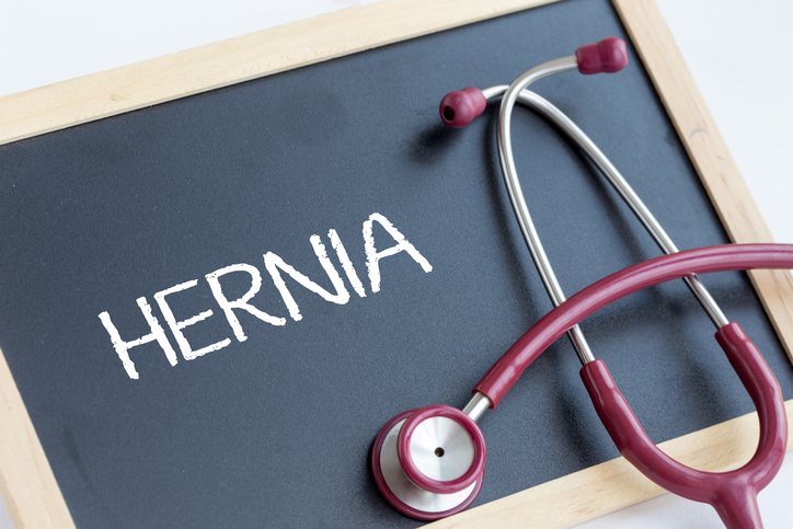 Síntomas y tratamiento de la hernia inguinal