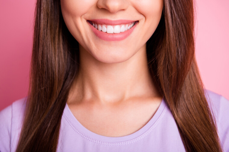 Las ventajas de las carillas dentales