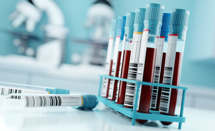 enfermedades hematológicas enfermedades hematológicas