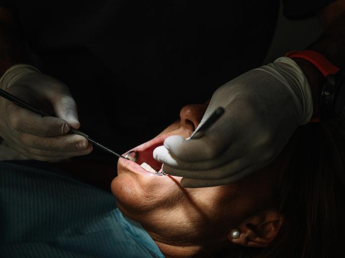 Atrofia ósea dental: por qué ocurre y cómo afecta a la posibilidad de colocar implantes